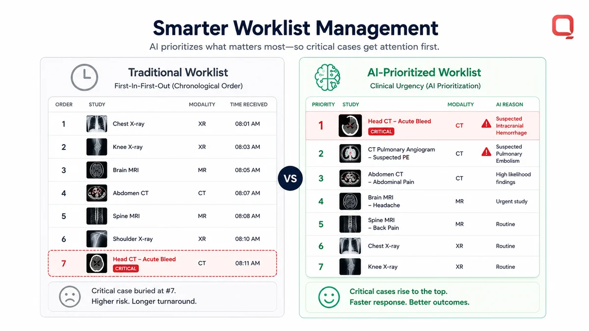 The benefits of AI-assisted radiology The benefits of AI-assisted radiology across the imaging workflow