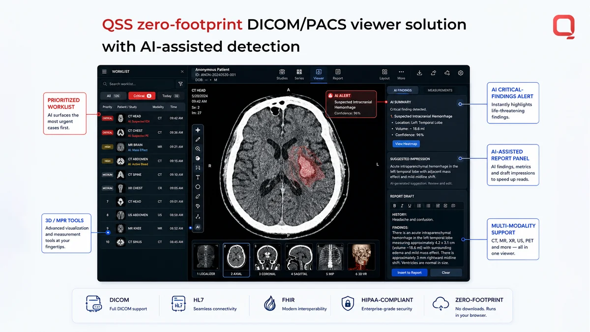 How QSS helps healthcare organizations adopt AI-assisted radiology QSS Technosoft zero-footprint AI-enabled DICOM/PACS viewer