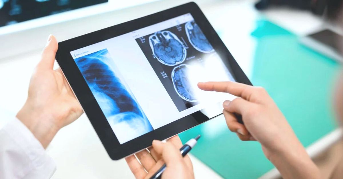 dicom serve software