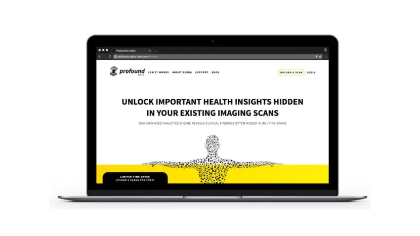 Zebra Medical Vision 